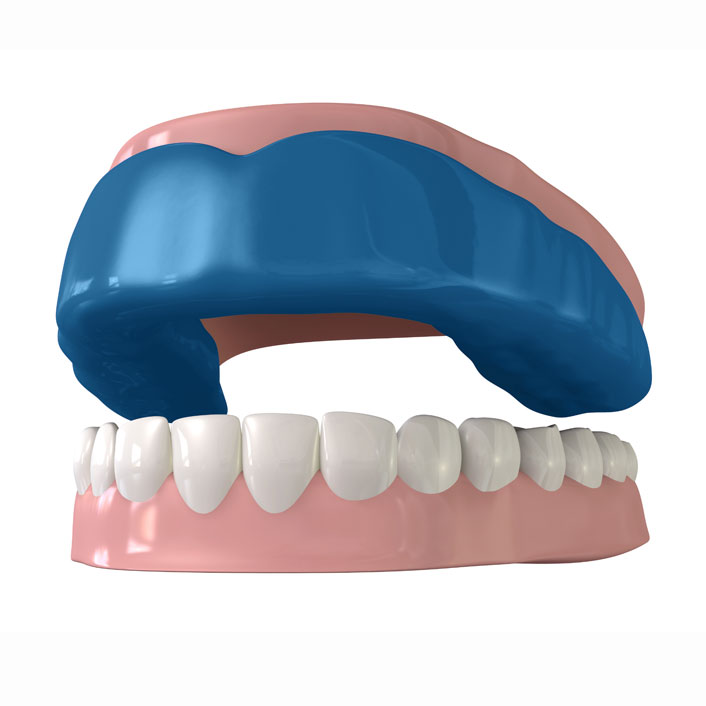 Mouth Guard - Dental Services